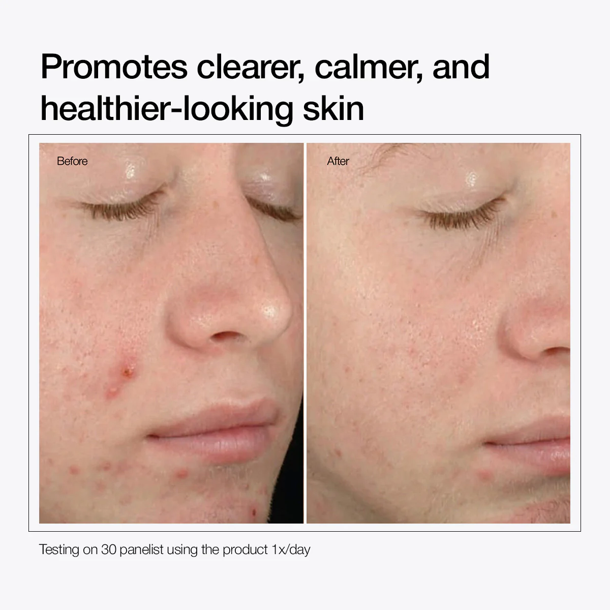 Salicylic Acid 2% Solution - Image 4