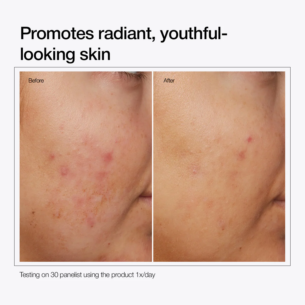 Niacinamide 10% + Zinc 1% - Image 4